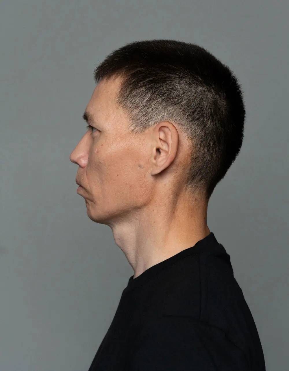 img-4